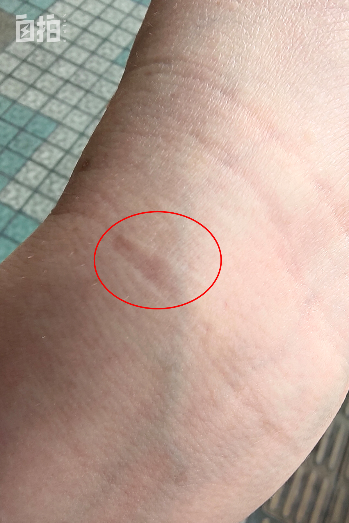 我15岁当模特，八十年代月薪过万，曾因吸毒自杀，现在帮人戒毒