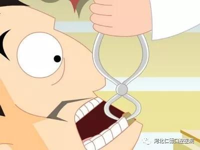 拔牙后吃什么食物比较好,拔牙后进食物残渣怎么办