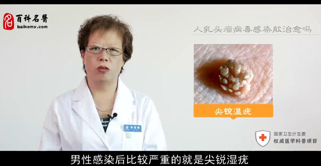 人乳头瘤病毒感染能治愈吗？