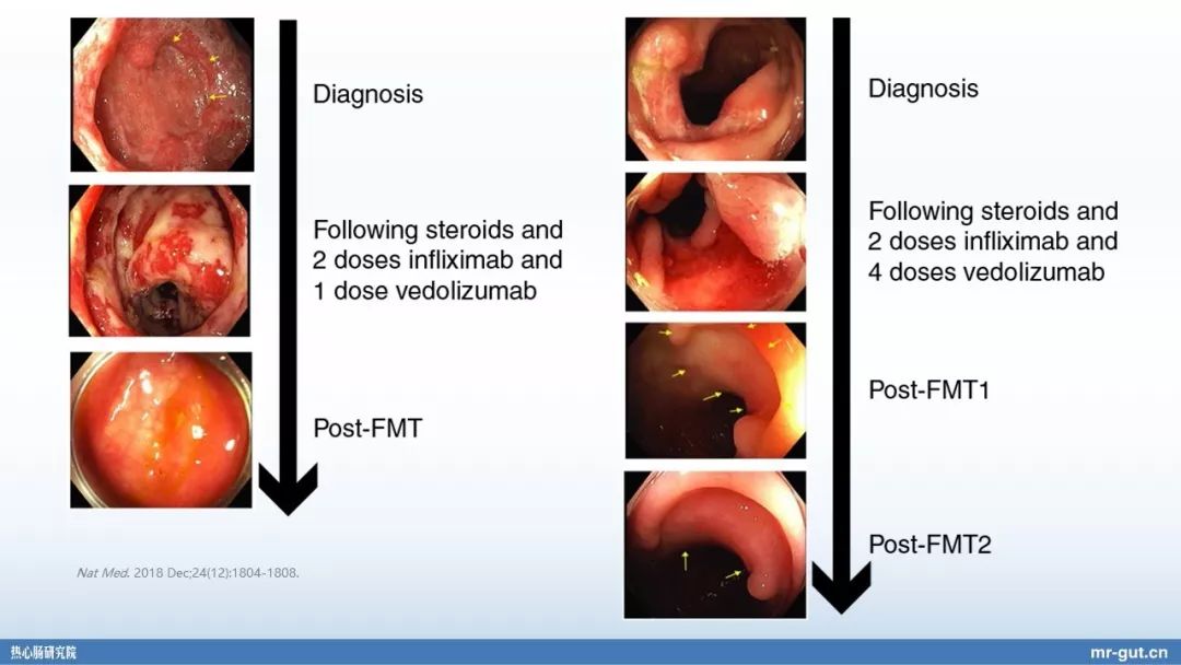 热心肠先生益生菌视频大全,热心肠先生全集