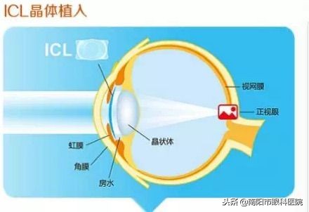 南阳眼科医院张春梅主任,张春梅眼科