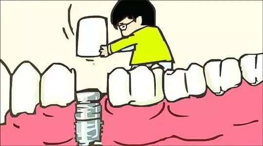 种植牙是什么成分,种植牙是什么英文