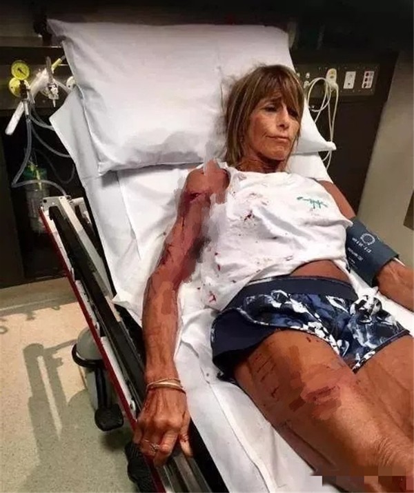 澳洲袋鼠真正的样子,真正的澳洲袋鼠