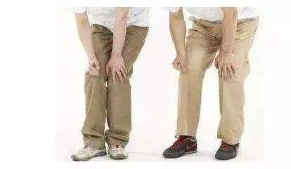 膝盖容易肿胀,膝盖肿胀部位对照表