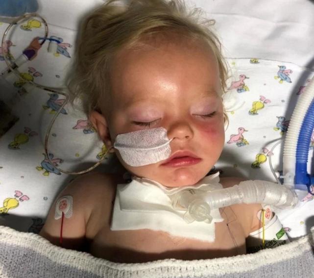 一岁宝宝被水杯砸到头部怎么办,小孩拿杯子被割伤