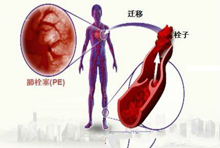 慢性病有哪些危险,哪些病不能长期坐车