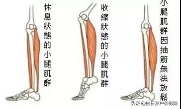 抽筋怎么快速消除,关于抽筋的应对方法你必须了解