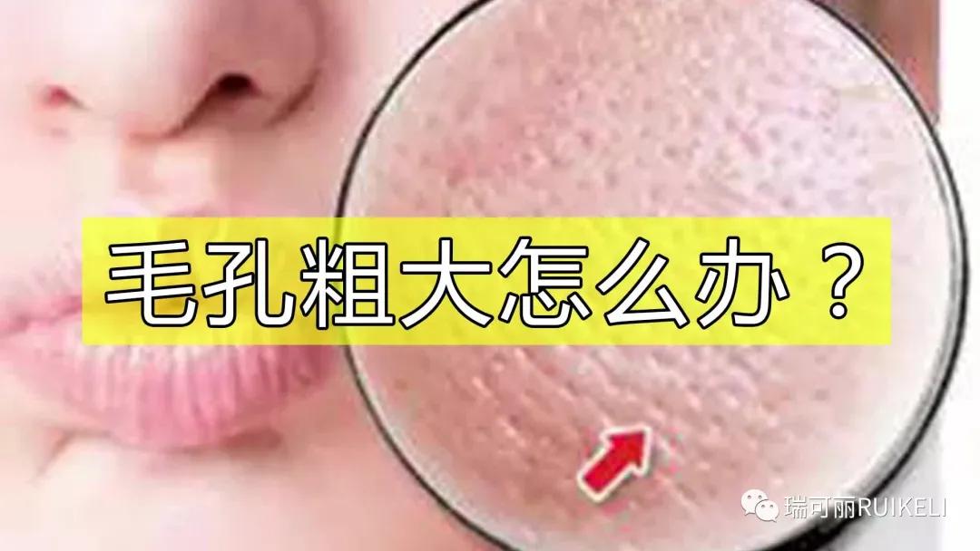 怎样让粗大的毛孔减少,毛孔变黑且粗大怎么治