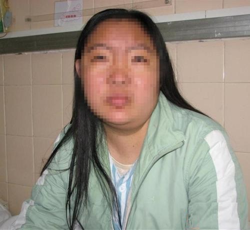 大头娃娃护肤品有什么危害,大头娃娃治好的几率有多高