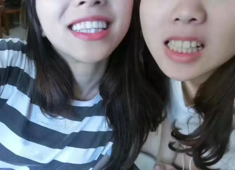 李佳琦给高晓松涂了口红，“美”得不像话？！不过牙齿是真的白