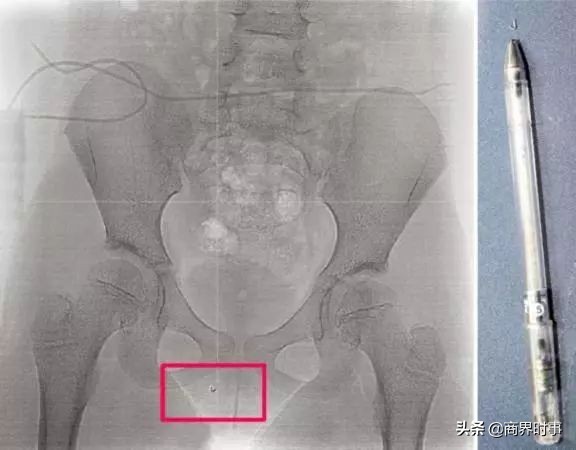 武汉封城53天，我看到了为人父母最丑陋的一面