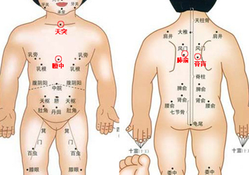 三伏贴如何治疗上热下寒,三伏贴治冬病的方法