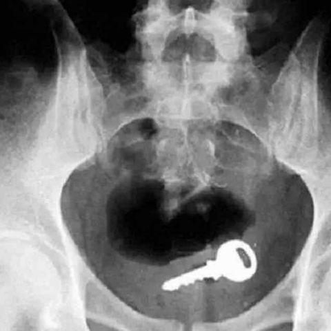 不作死就不会死看看你中了几条,不作死就不会死让人看的头皮发麻