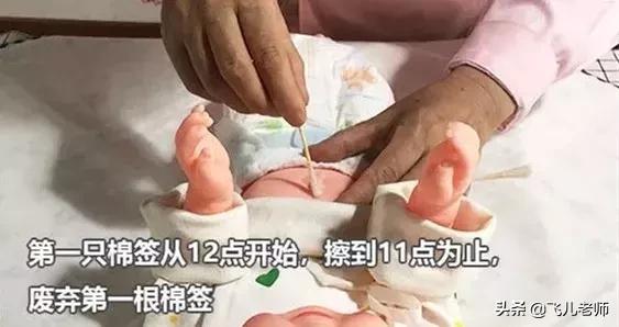 新生儿脐带一个月了还不掉怎么办,新生儿脐带一个多月未脱落