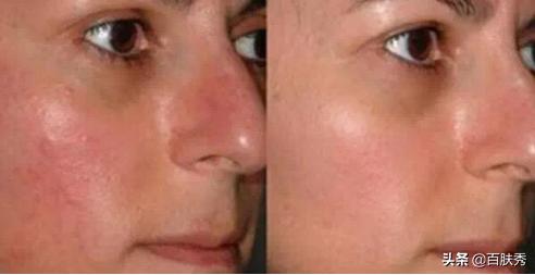 别再被所谓外油内干肤质忽悠了,适合外油内干肤质的温和护肤品