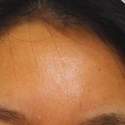 科颜氏抗初老精华露元气弹,科颜氏小白瓶跟元气弹