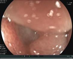 龙华区中心医院多学科协作成功救治水电解质、酸碱平衡紊乱患者