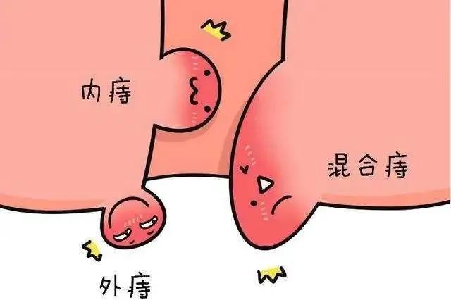 大便堵在肛门排便不尽,甲硝唑栓能治肛门坠胀大便不尽吗