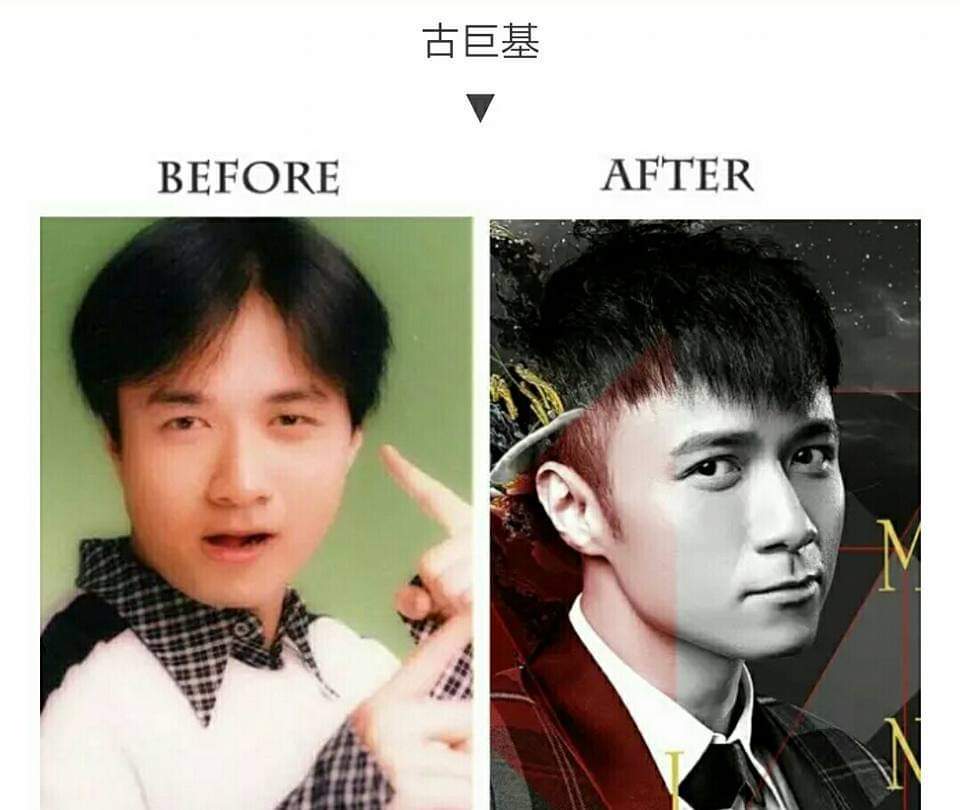 “女看眼，男看鼻”，塌鼻梁的男生如何改善？