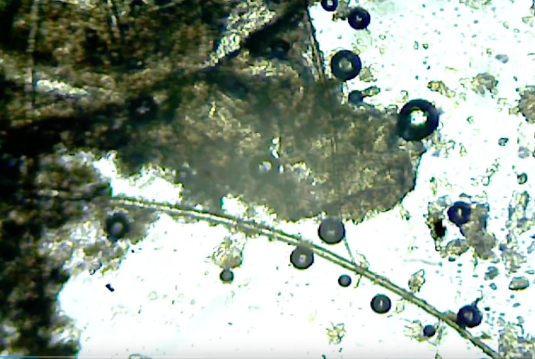 耳屎用显微镜放大是什么样,耳屎在显微镜下是不是活的