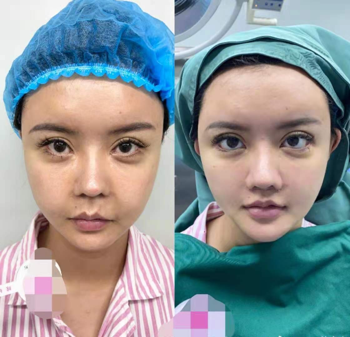 网红韩安冉整容了吗,网红失去滤镜后韩安冉整容明显