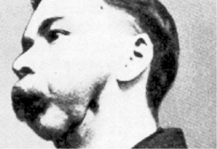 吃一口核废料会怎样？外国富豪把镭当补药，连喝1400瓶含镭药水