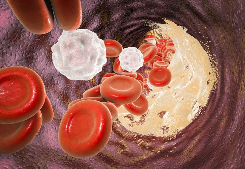 脑梗死一个星期的变化,时间就是生命急救技巧