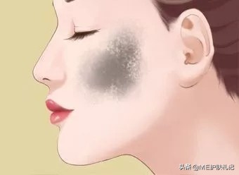 小分子胶原蛋白去皱祛斑?,薇绮美胶原蛋白淡化色斑