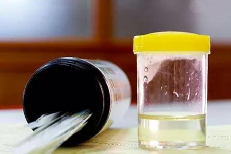 激素治痛风急性发作期的效果真好,激素治疗痛风伤肾