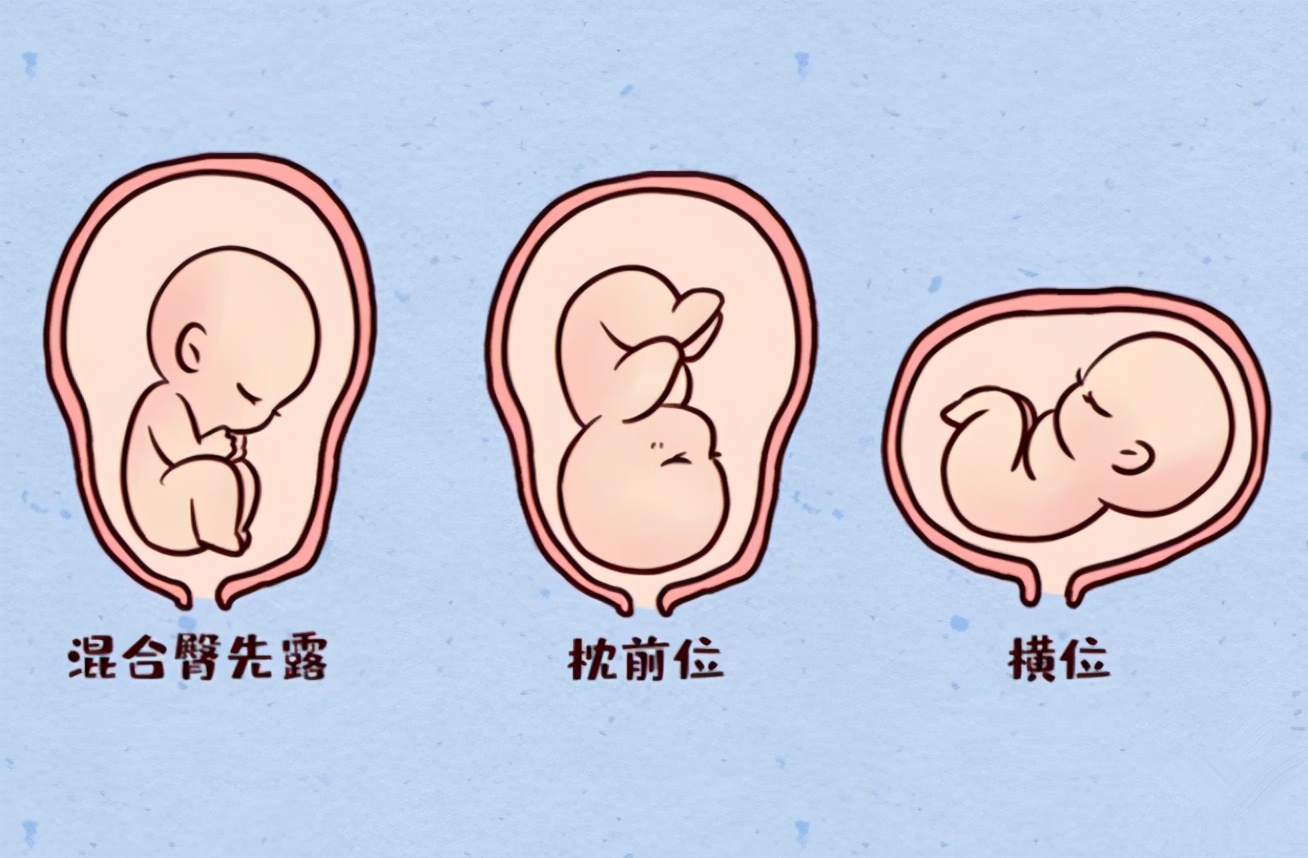 孕肚鼓大包和鼓小包的区别,孕肚扁宽是女儿吗
