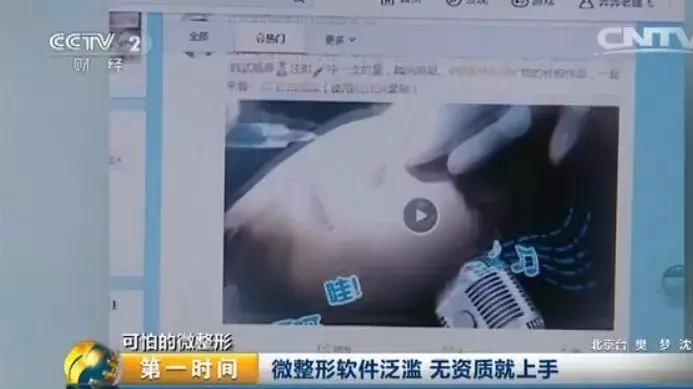 女子整容换脸后续,整容死亡真实案例