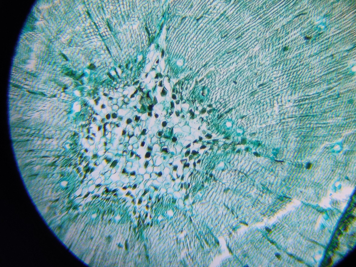 花式搞机:投影仪加上手机投屏秒变显微投影设备