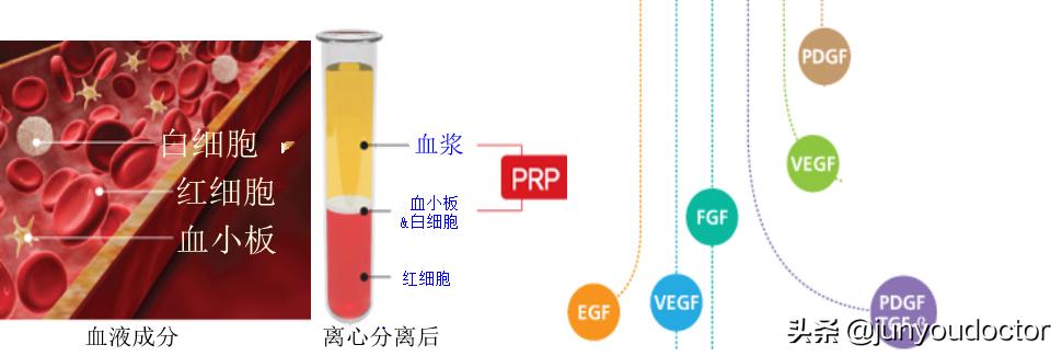 我(PRP)的超能力是富予人体超强自愈力