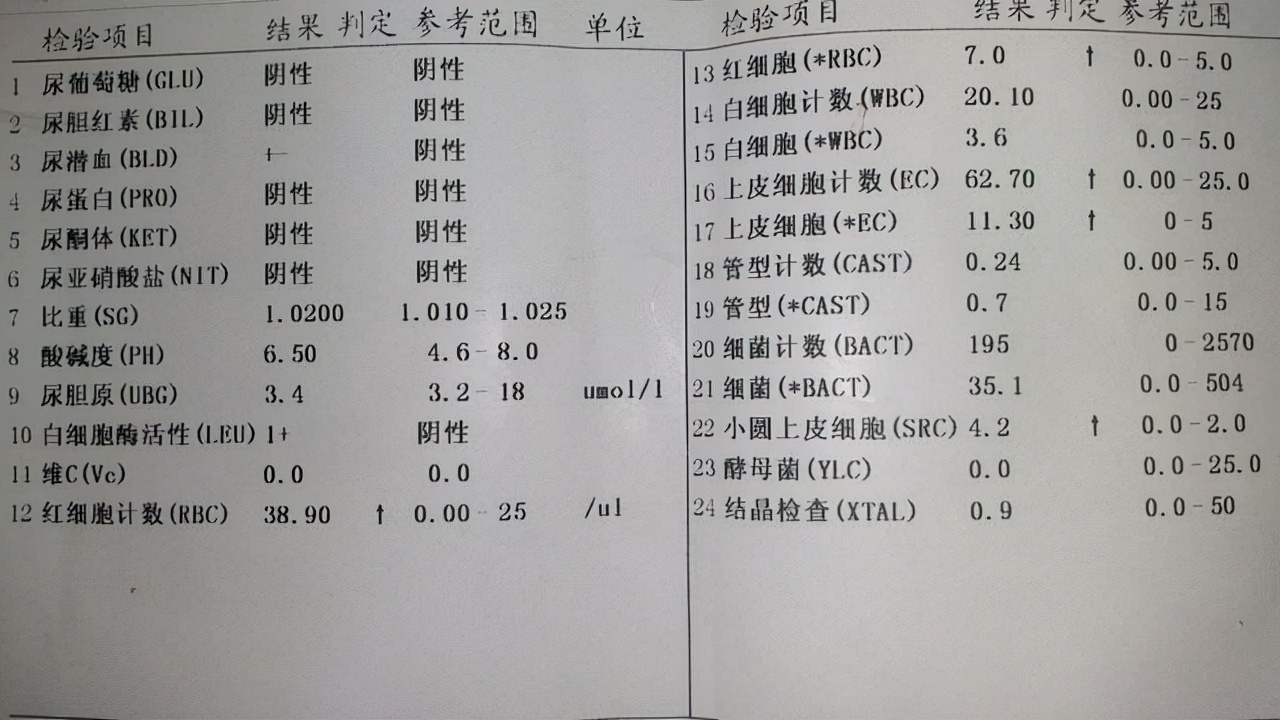 每天喝一杯蜂蜜水身体会怎样？杭州小伙2个月“暴瘦”20斤