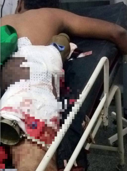 迫击炮真实战争,迫击炮rpg