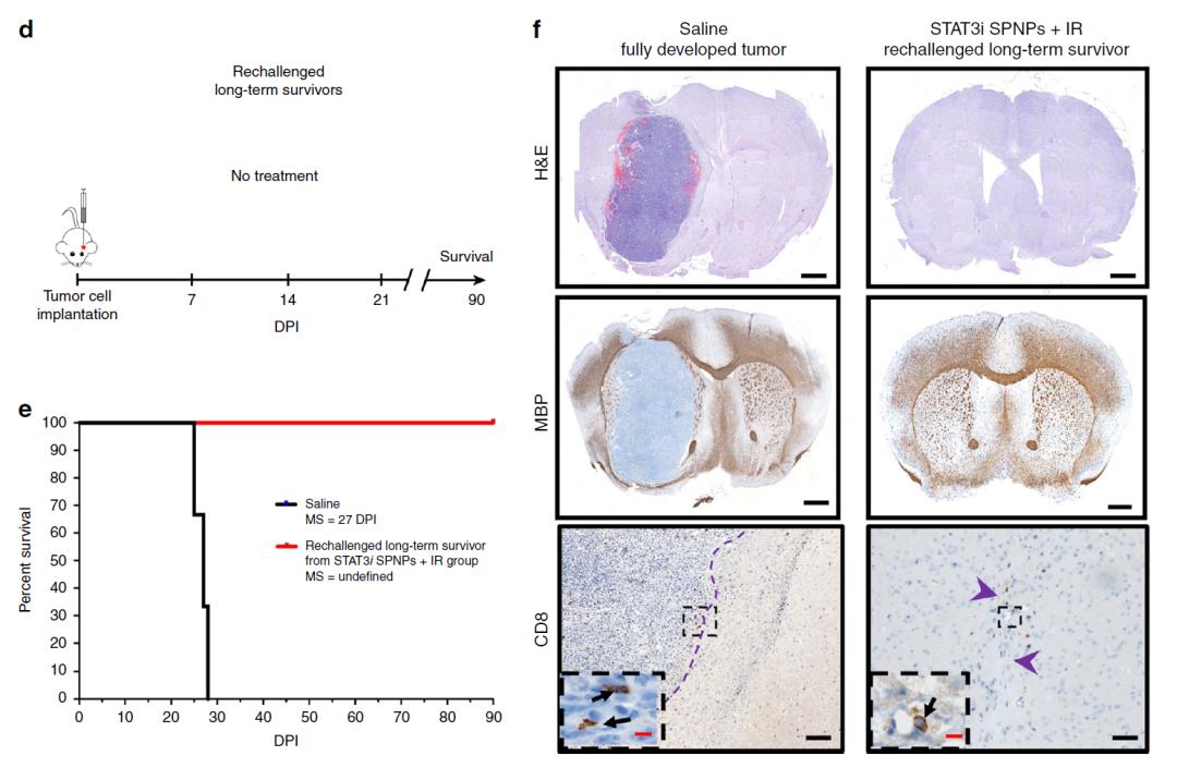 恶性脑肿瘤没扩散能治愈吗,脑肿瘤有自己消失的吗
