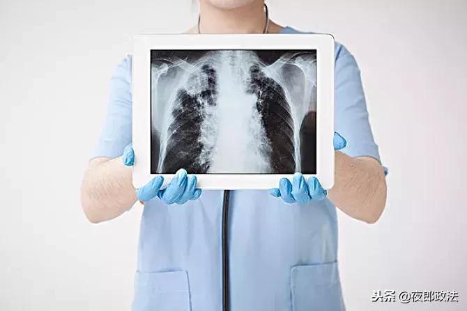 戒烟20年烟龄的方法,戒烟两年后烟瘾彻底消除真实案例