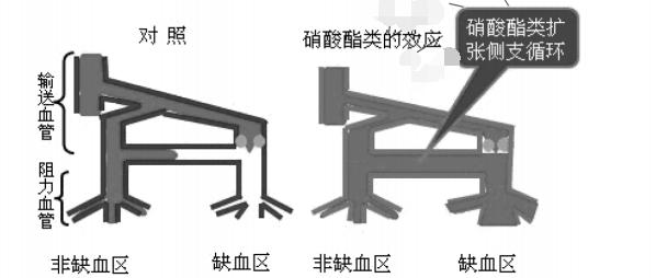 治疗冠心病心绞痛的四种常备药,心绞痛硝酸酯类药物有哪些