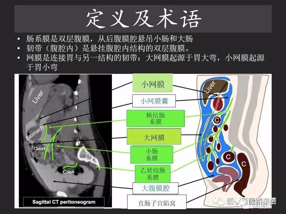 空腔脏器穿孔和胃肠道穿孔区别,腹膜后穿孔一般是哪里穿孔