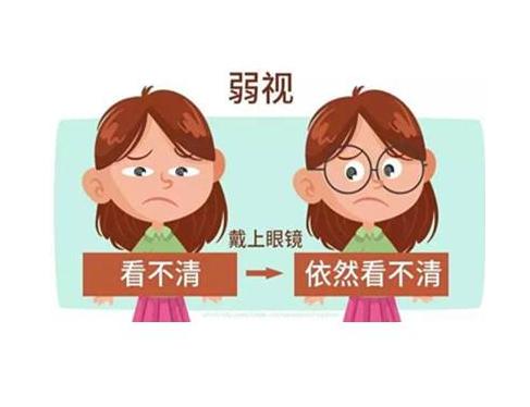 视力矫正加盟怎么推广,近视矫正加盟价格实惠