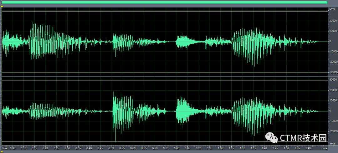 磁共振成像的基本原理和优缺点,为什么磁共振成像要很久
