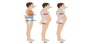 颈肩和腰痛的自我诊断,肩颈腰痛怎么引起的