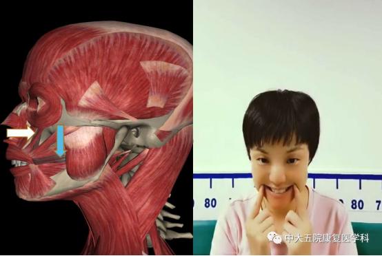 面瘫临床表现的科普视频,科普面瘫多久治疗效果最好