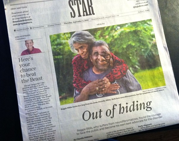 全身肿瘤怎么治疗,浑身长满肿瘤怎么办