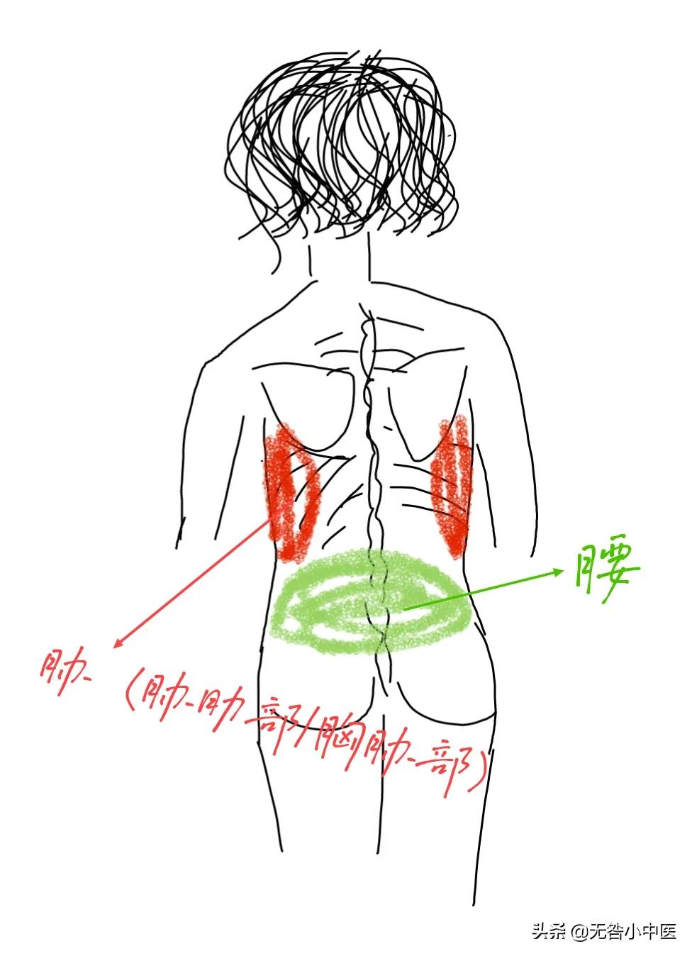 针灸腰部三根大针,针灸治疗腰突三周了