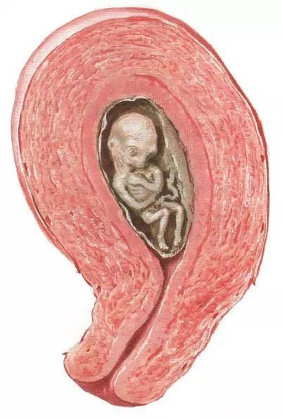 胚胎停育，不要忽略我们身边的“隐形杀手”