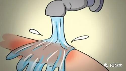 现场处理轻度烧烫伤最佳急救措施,对于烧烫伤的伤病员现场处理方法