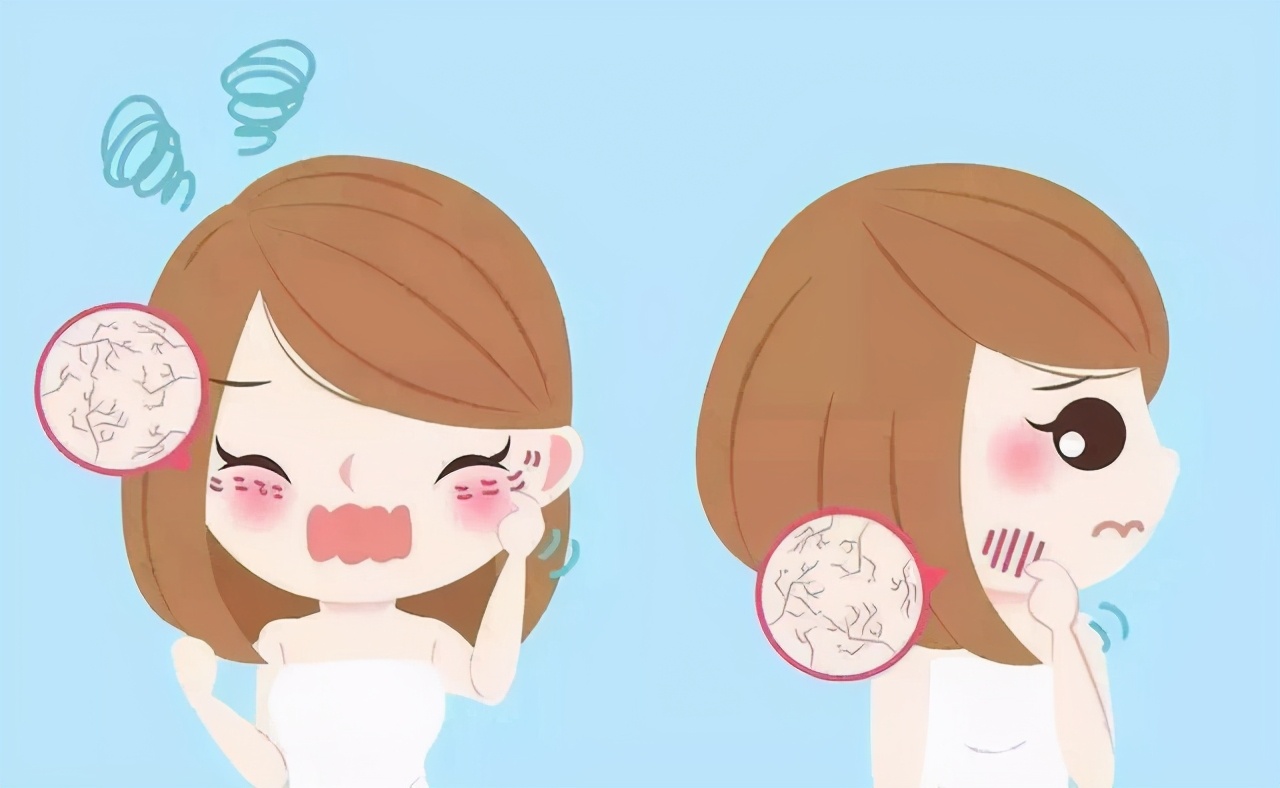 唇周黑敏感紧绷干燥起皮怎么办,脸起皮干燥紧绷刺痛发红用什么药