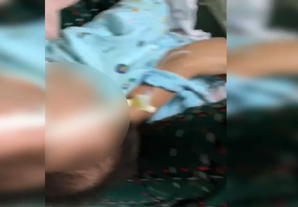 婴儿腰椎穿刺两次没成功,宝宝腰穿刺失败