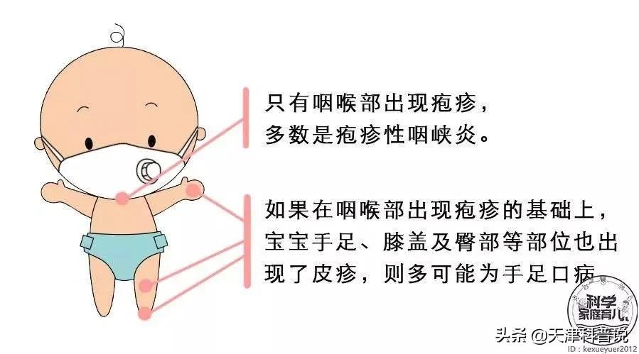 手足口病高发期!这九个问题你都知道吗?